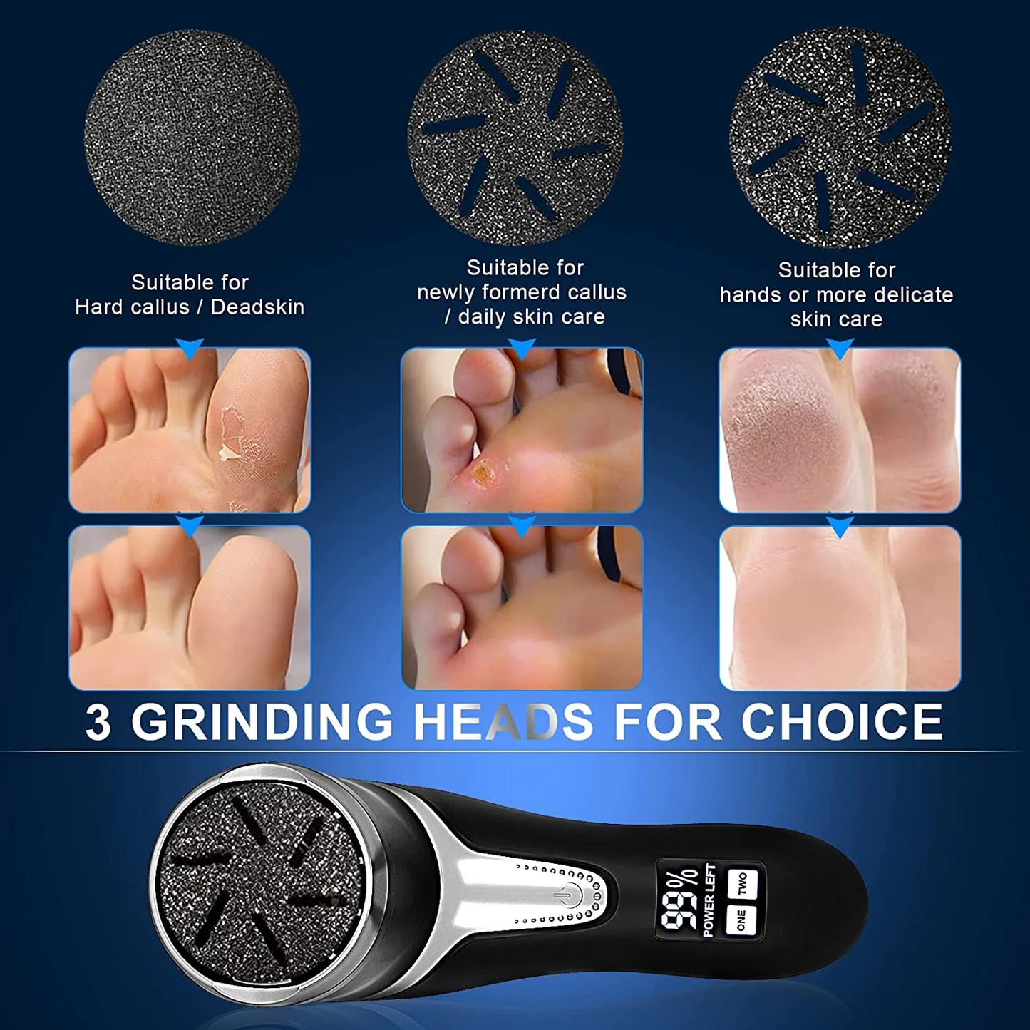 Rechargeable Electric Foot File – Waterproof Callus Remover with 3 Rollers & LCD Display for Smooth, Healthy Feet